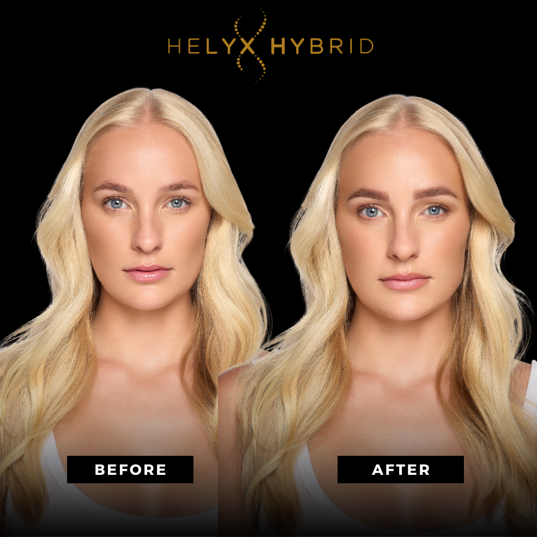 Vorher- und Nachher-Make-up einer Frau mit der Aufschrift Vorher und Nachher unter Verwendung von Elleebana Helyx Hybrid Farben, 15ml. Blashy Shop