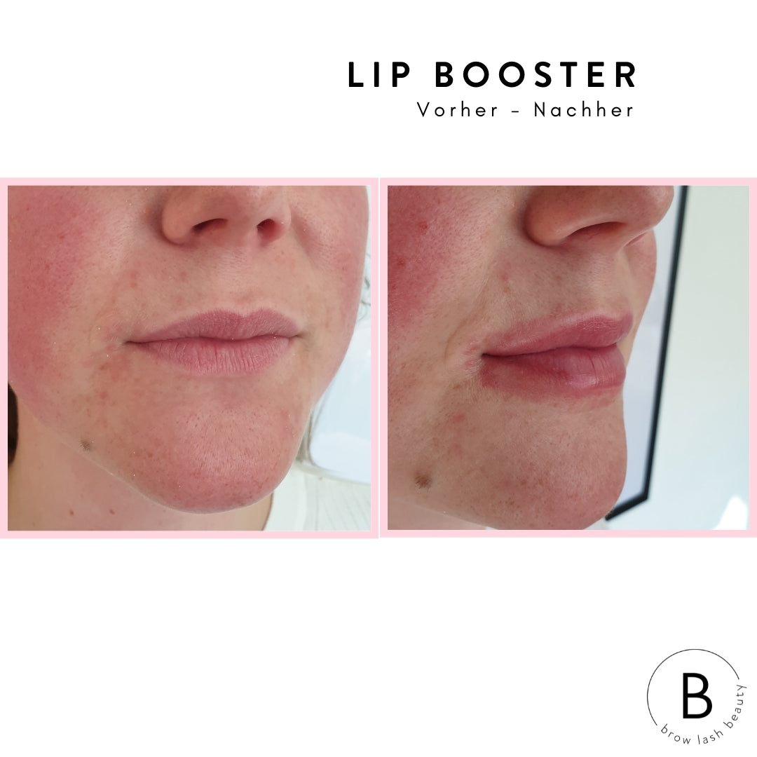 Lippen vor und nach der Anwendung von Lip Booster Technik aus dem LIP BOOSTER Online Kurs von Lash&Brow Academy Online. Blashy Shop