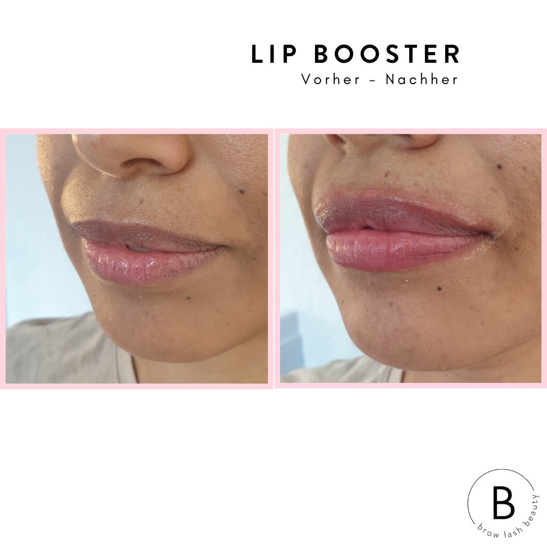 Lippen vor und nach dem LIP BOOSTER Online Kurs von Lash&Brow Academy Online, die das verstärkte Volumen zeigen. Blashy Shop