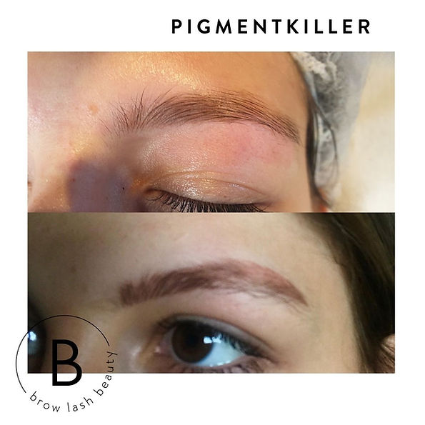 Sehen Sie die Vorher/Nachher-Ergebnisse der Pigmententfernung von Profis mit dem PIGMENTKILLER Online Kurs von Lash&Brow Academy Online. Blashy Shop