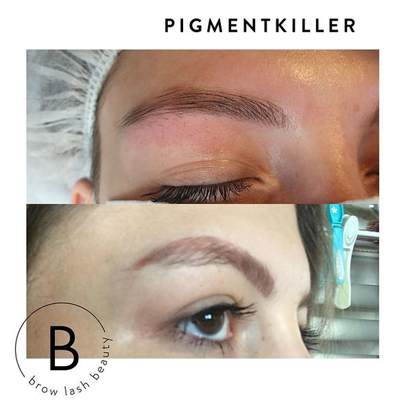 Vorher-nachher Pigmententfernung: Zwei Augenbrauen-Nahaufnahmen nach dem PIGMENTKILLER Online Kurs von Lash&Brow Academy. Blashy Shop