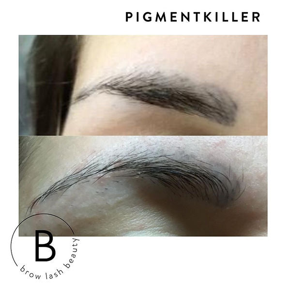 Vor und nach der Augenbrauenpigmententfernung mit dem PIGMENTKILLER Online Kurs von Lash&Brow Academy Online. Blashy Shop