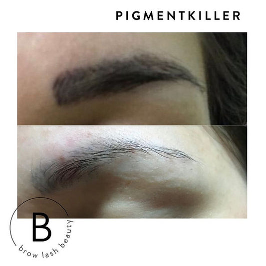 Nahaufnahme der Augenbrauen vor und nach Pigmentkiller verbesserte Formel von BM Colors; die obere Braue ist pigmentiert, die untere ist heller. Blashy Shop