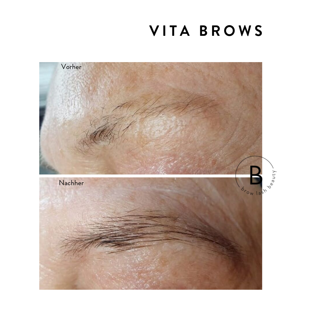 Vor und nach der Anwendung von Blashy BROW ENERGIZER WACHSTUM von Lash&Brow Academy Online wirken die Brauen sichtbar voller. Blashy Shop