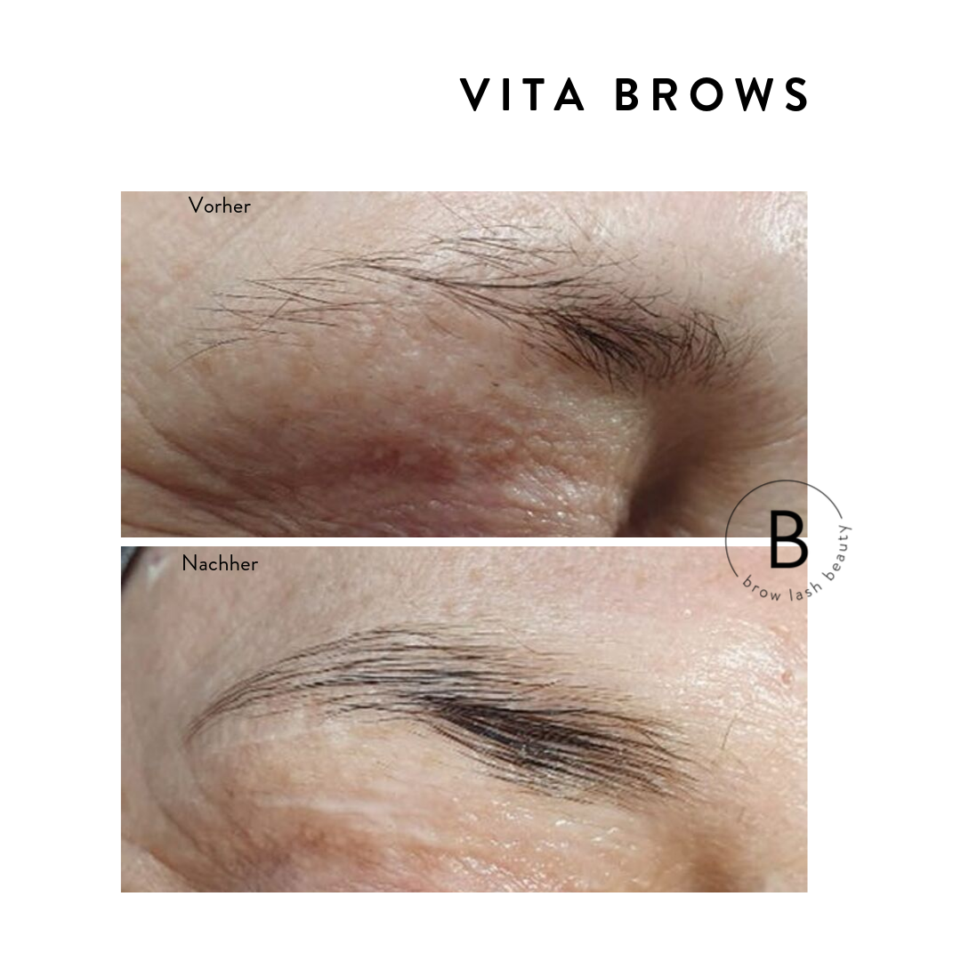 Nahaufnahme der Brauen vor und nach dem Blashy BROW ENERGIZER WACHSTUM Online Kurs von Lash&Brow Academy Online: vollere, definierte Brauen. Blashy Shop